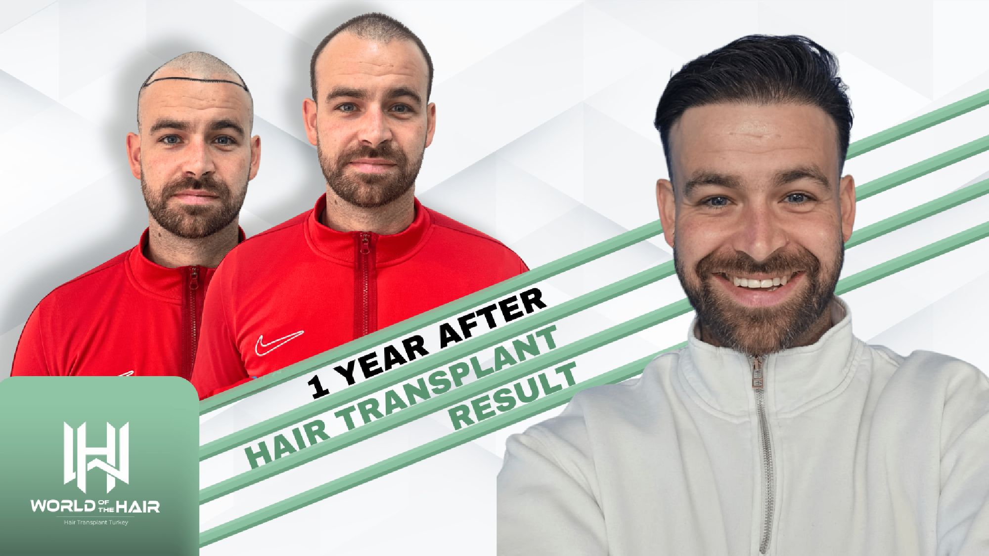 1 Year After