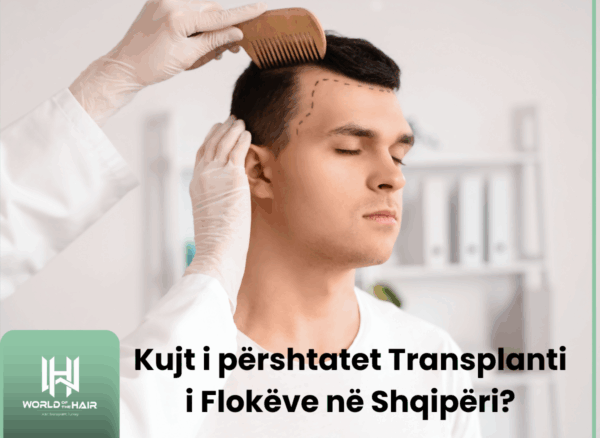 Kujt i përshtatet Transplanti i Flokëve në Shqipëri?