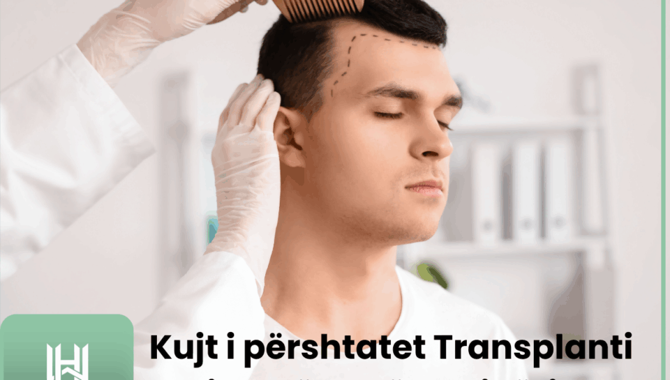 Kujt i përshtatet Transplanti i Flokëve në Shqipëri?